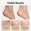 Magnesium Chloride Cream, Gentle Moisturizing Body Massage, Easy to Apply Soothing Daily Care 60g