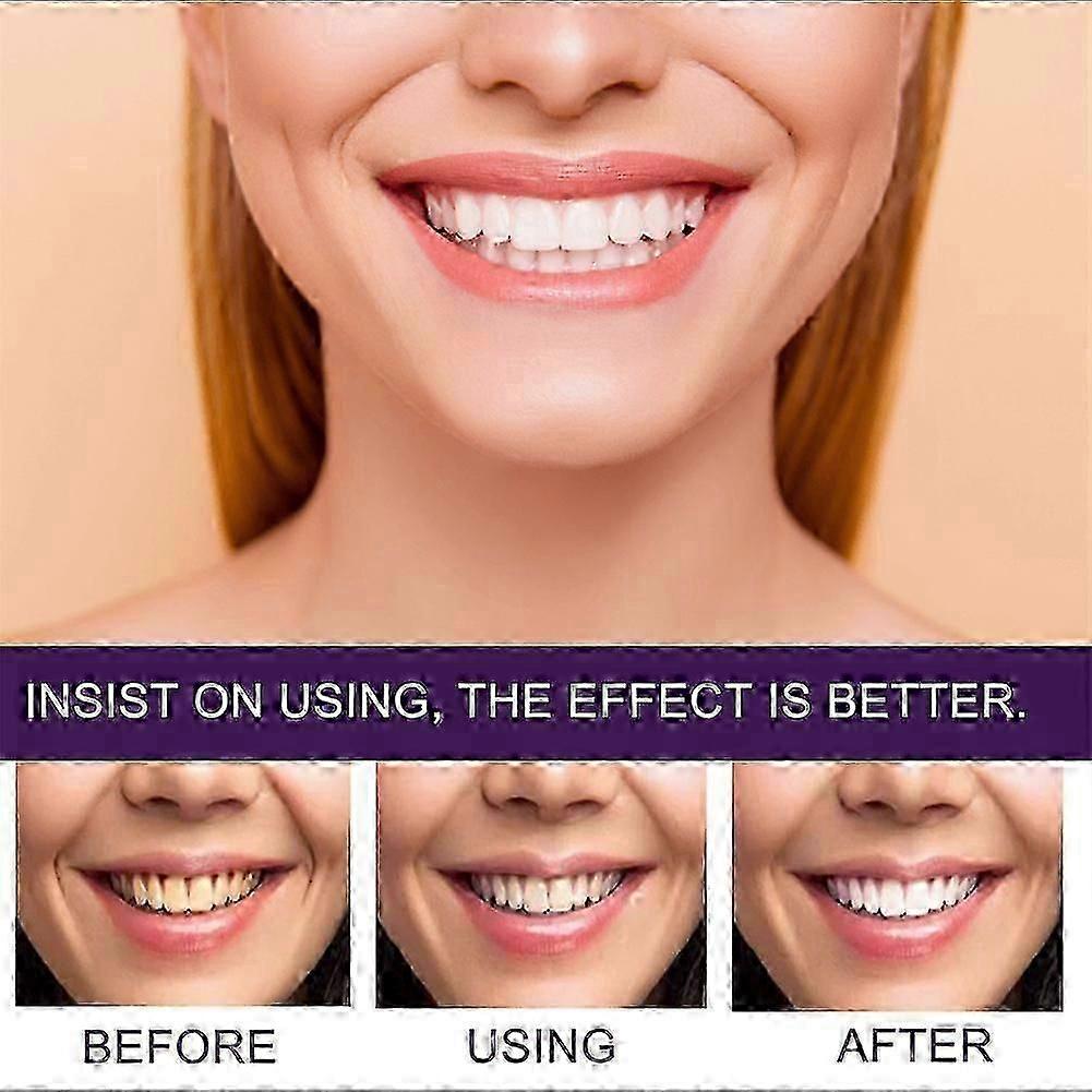 Eelhoe Purple Tooth Beautifying Toothpaste Niacinamide Whitening Yellow Tooth Remove Stains