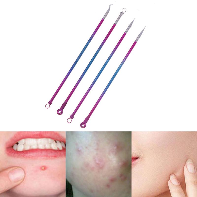 4Pcs Blackhead Facial Acne Pimple Pore Remover Tweezer Curve Extractor Set Kit
