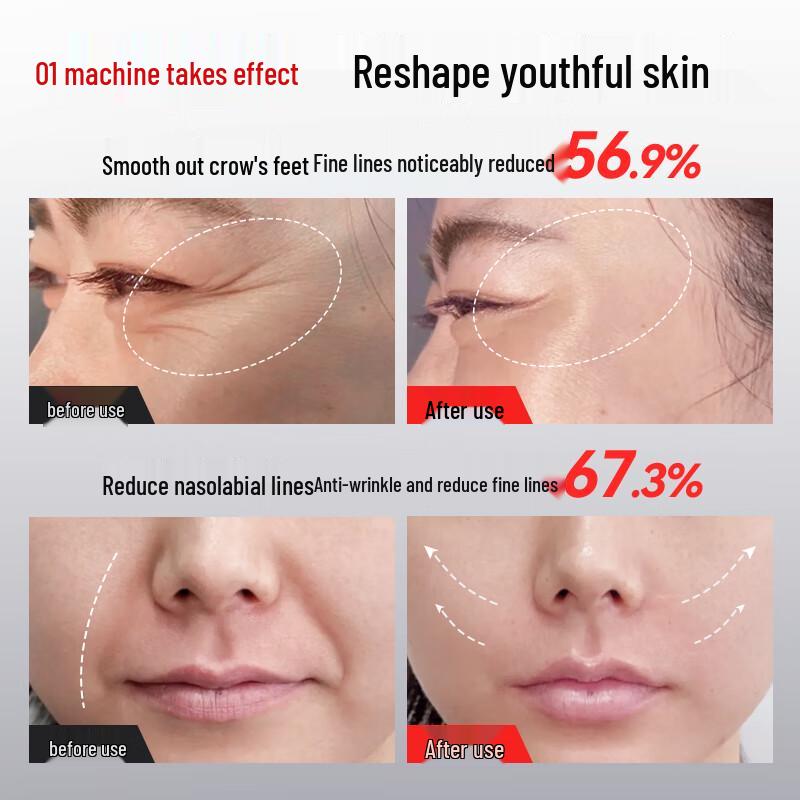 Collagen Gun Facial Massager with Red & Blue Light Therapy CN Plug (adapter Included)