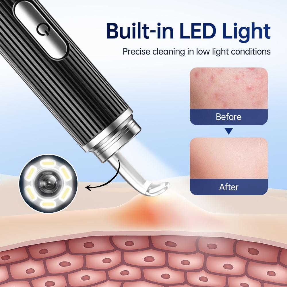 Visual Blackhead Remover with Camera Pimple Popper Extractor Tool Pore Cleaner Kit for Acne Comedone Whitehead Black Dots Remove