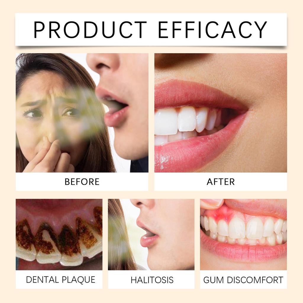 40g Oralhoe Herbal Gum Powder Herbal Care Clean Teeth Clean Fresh Yellow Stains Clean Teeth