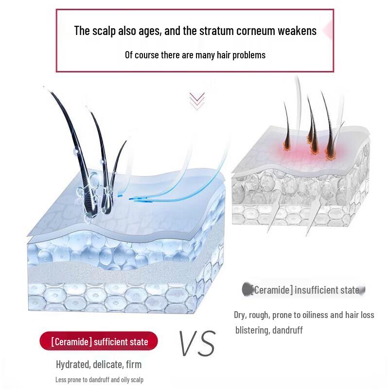 ShuLei PRO Oily Scalp Oil Control Anti-Dandruff Shampoo