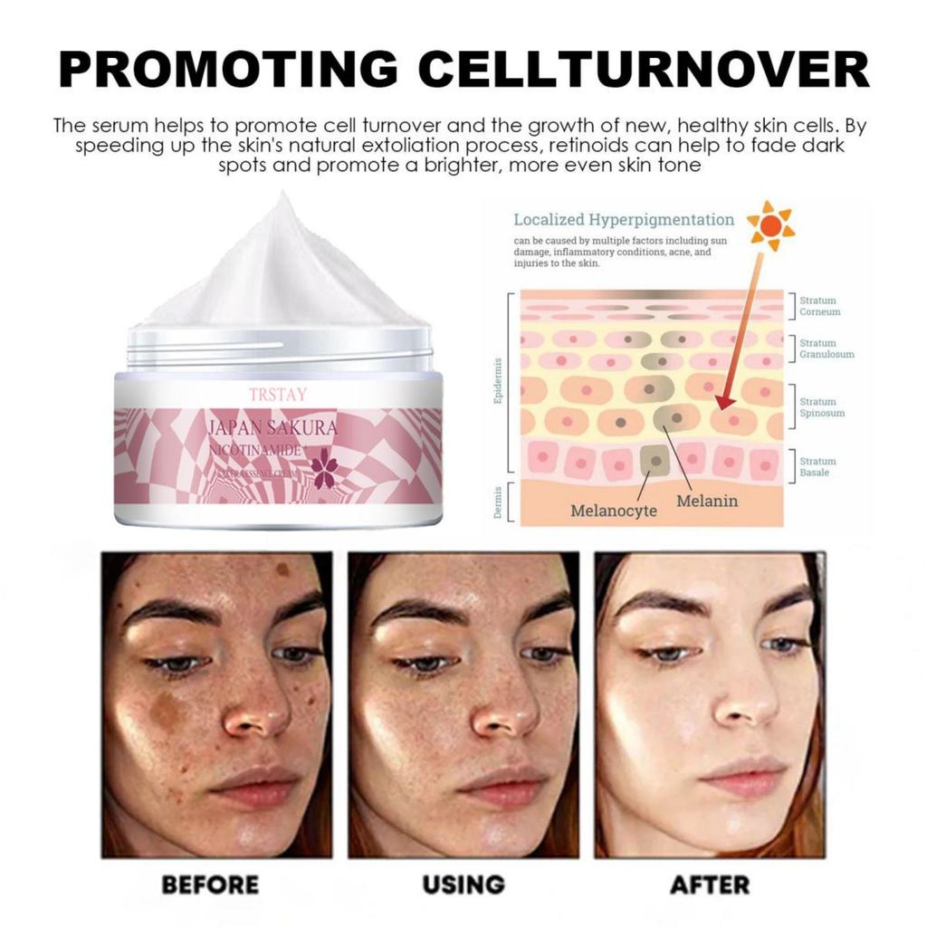 TRSTAY Moisturizing Cream, Vitamin C Brightening Face Cream, Brightening Skin And Lightening Spots