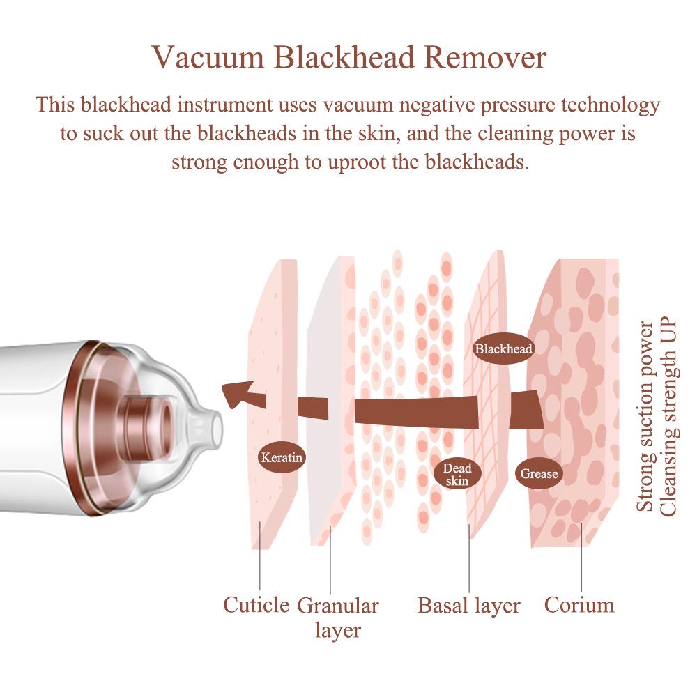 Rechargeable Blackhead & Pore Cleaner Suction Instrument