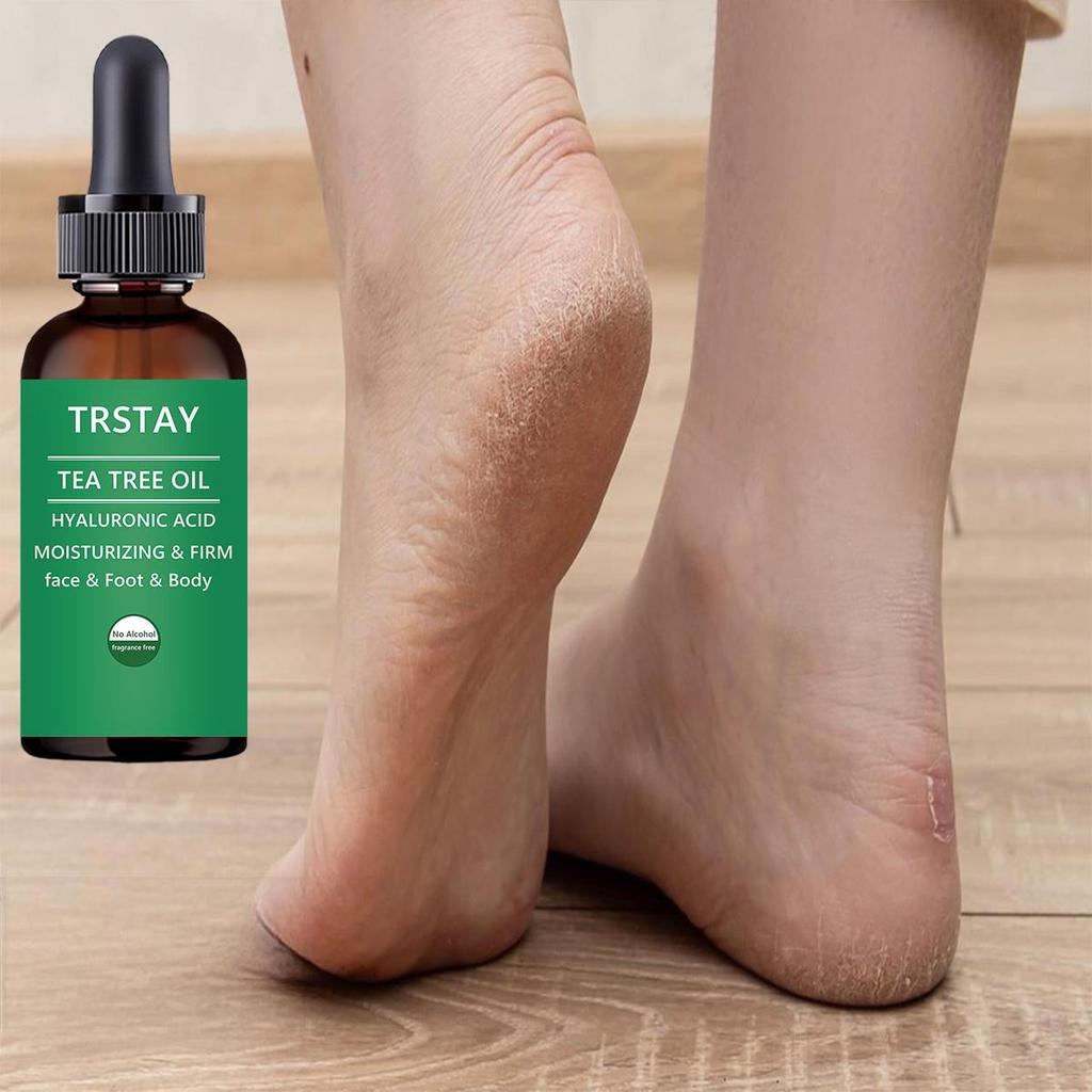 Fotbehandling:  Botanisk fotkrem Fuktighetsgivende fotpleieessens for tørr hud, sprukne hæler, sterk helbredende kraft, soppdrepende