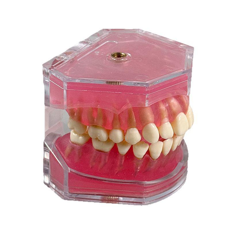 Dental Implant Teaching Model & Toothbrush Preparation Resin Mold