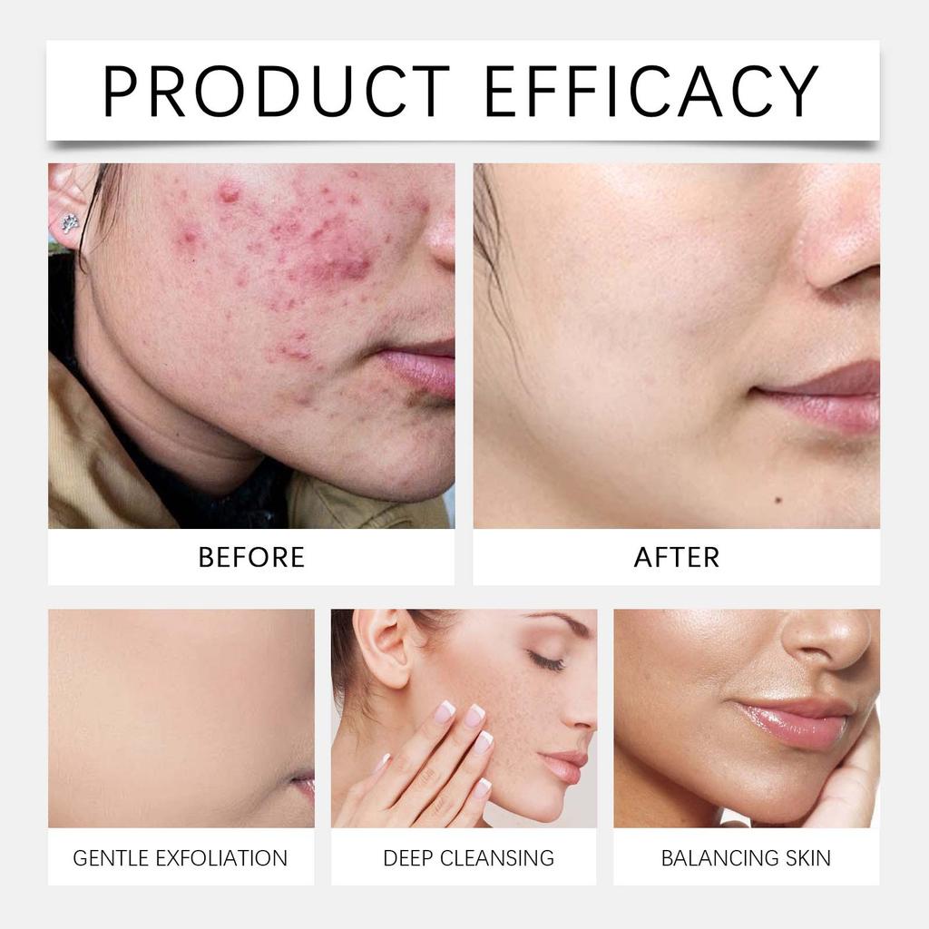 Peeling-Pads reduzieren Mattheit, gleichen den Hautton aus, verlangsamen die Hautalterung, spenden tiefenwirksam Feuchtigkeit, straffen und festigen die Haut, peelen. 20 ml