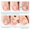 Stainless Steel Lever Hook Ingrowns Toenail Tool Elastic Bands Adjustable Corrector For Men And Women