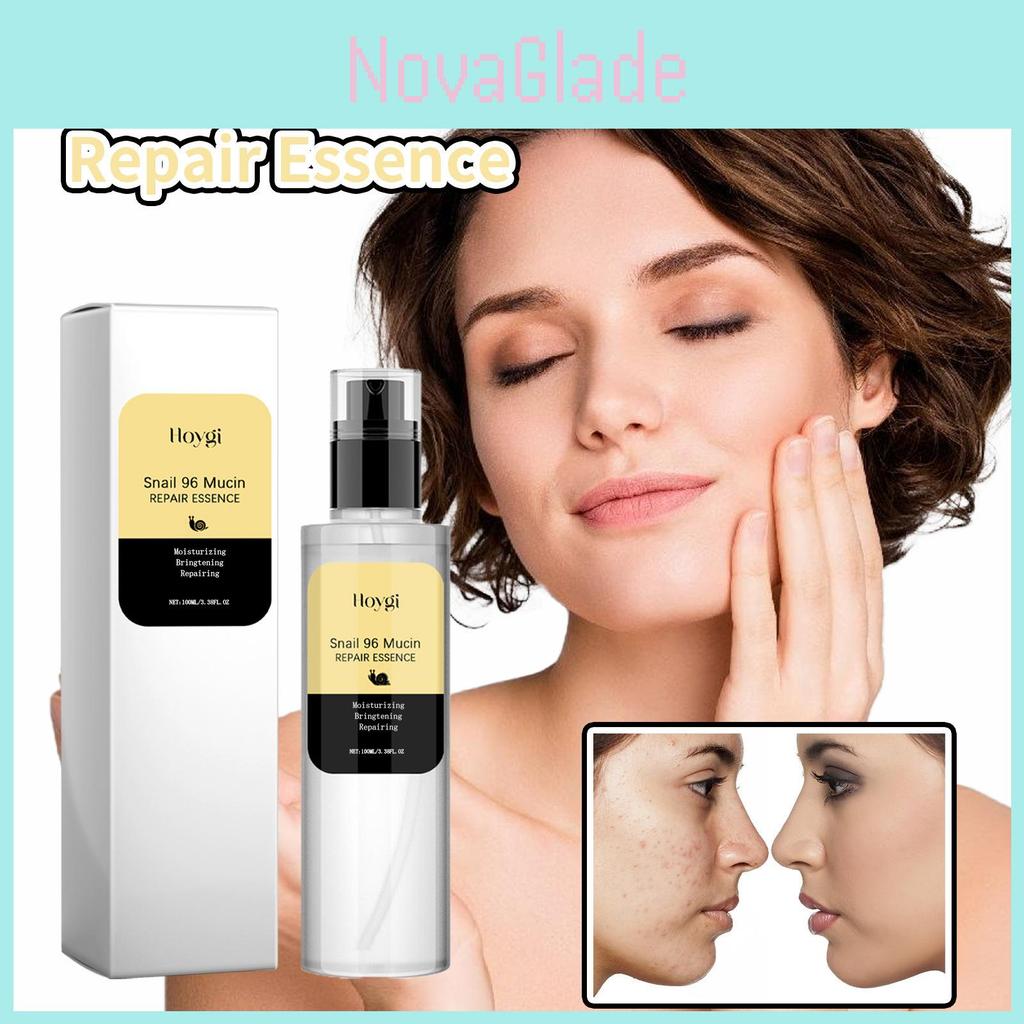 Hoygi Snail Collagen Essence Serum For Youthful Skin Hydration And Fine Line Reduction