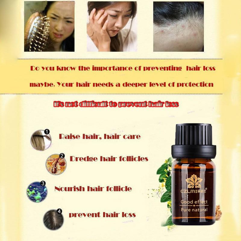 Essence de croissance des cheveux, guérison naturelle de la perte de cheveux, croissance plus rapide, huile essentielle