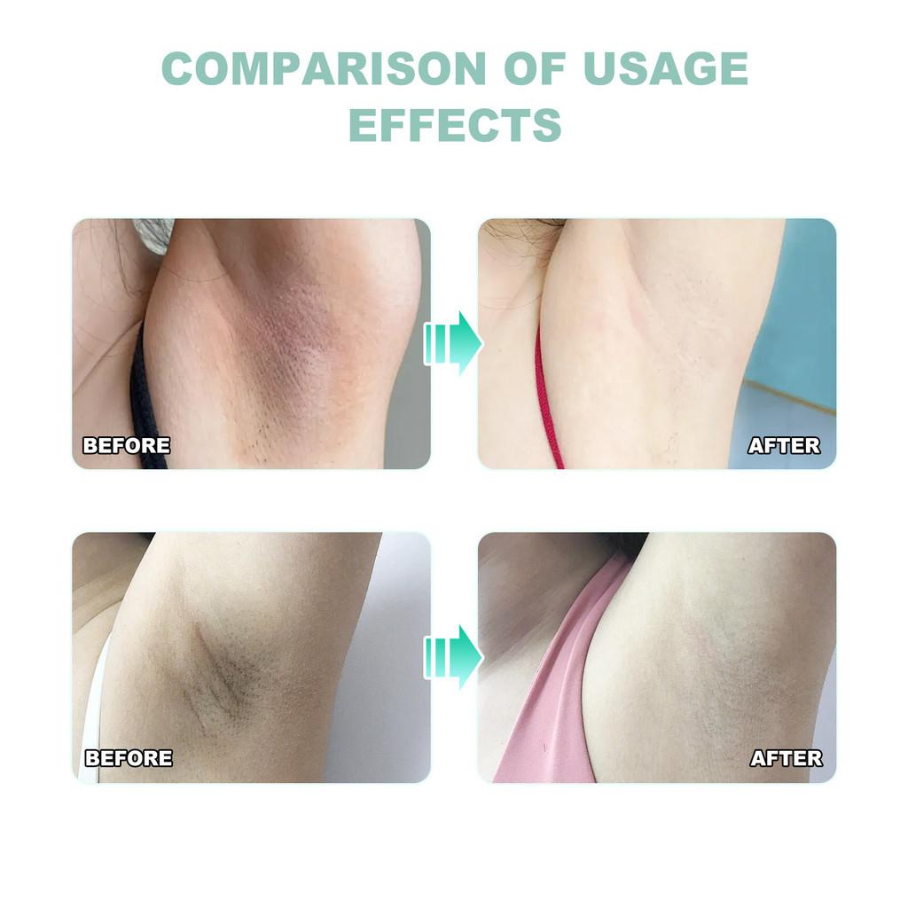 Green Tea Underarm Deodorant Spray For Long Lasting Freshness And Odor Control 40ml