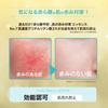 Red Clear Prevents Redness of the Face and Contains Glycyrrhizin and Tranexamic Acid Anti-Signal 20g, Quasi-drug, Skin,