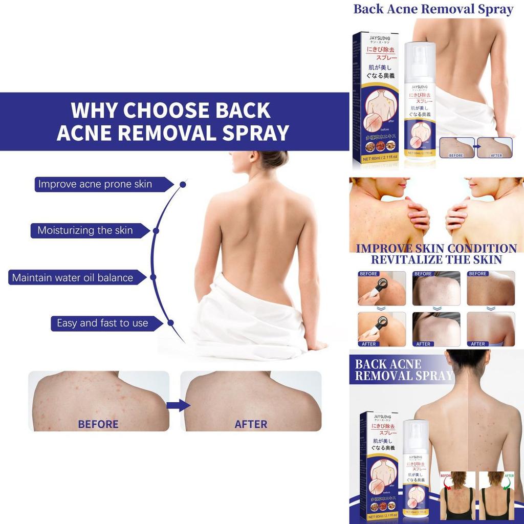 Jaysuing Back Care Spray For Fading Acne Marks And Smoothing Skin Texture
