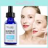 Glycolic Acid Exfoliator Chemical Exfoliant Brightens Your Complexion Supplies