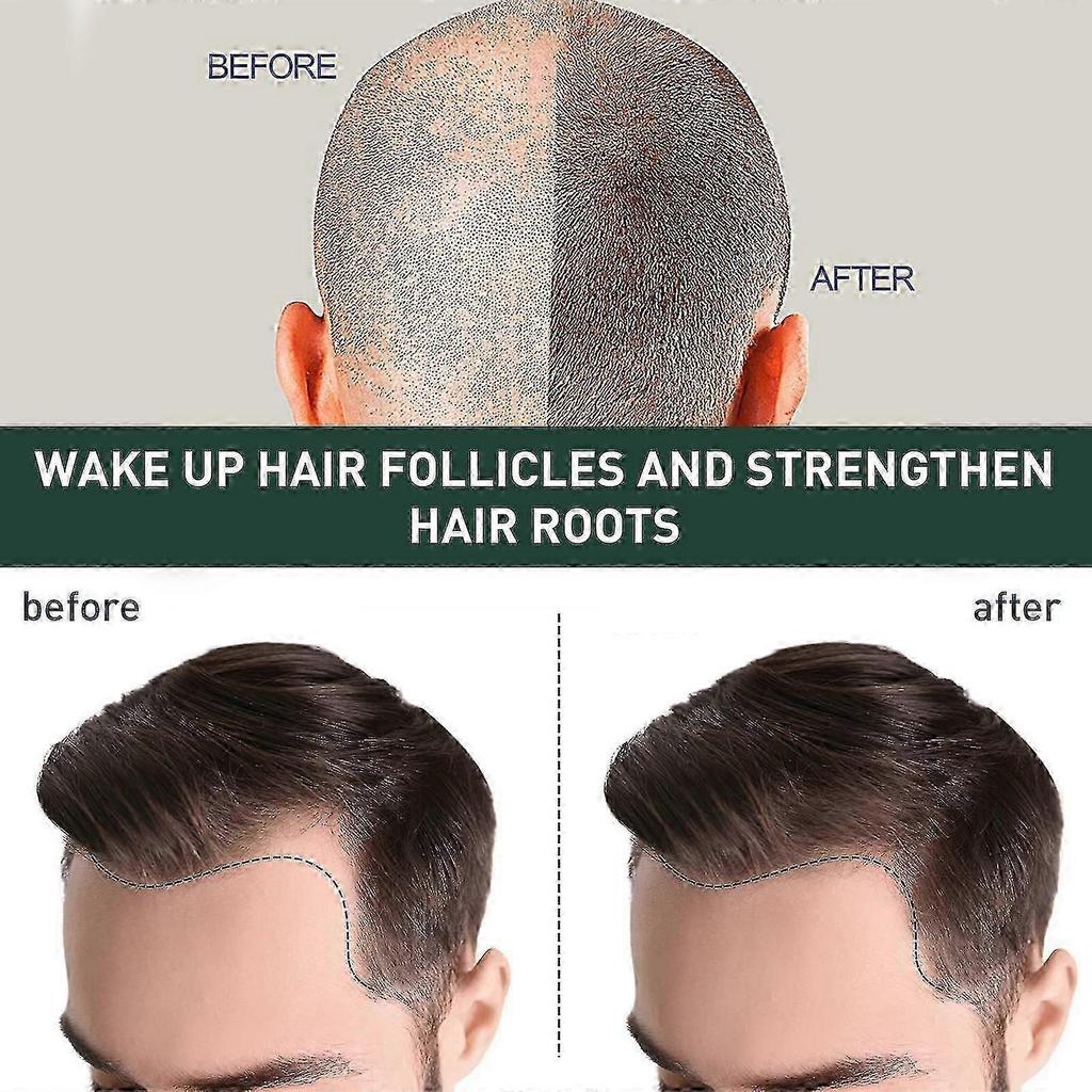 7-Day Hair Growth Serum - Anti-Hair Loss Treatment for Thicker Hair (30ml)