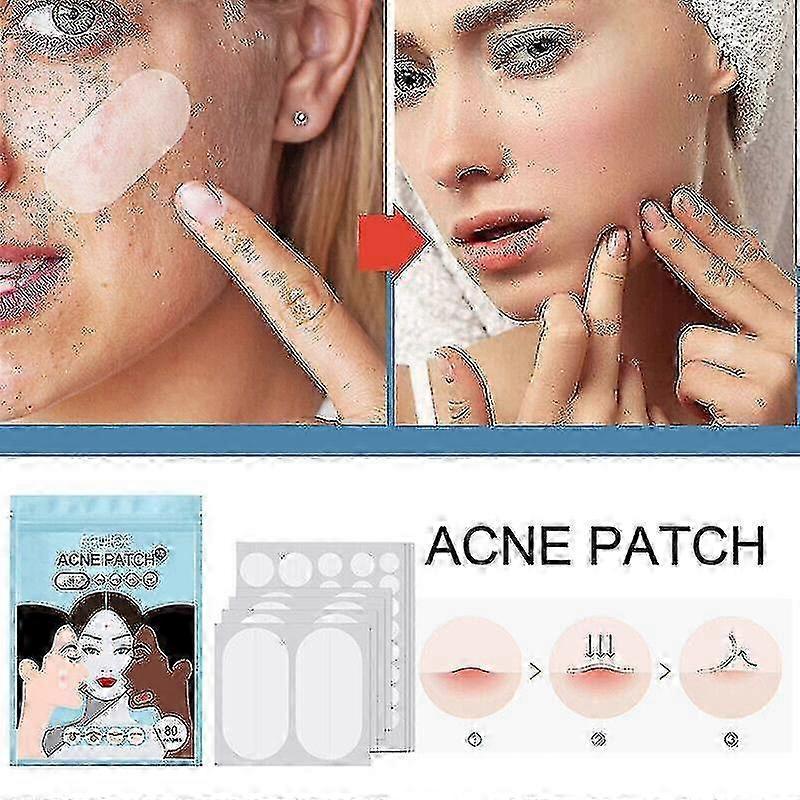 320pcs Large Acne Patch Pimple Hydrocolloid Stickers Spot Cover Remover Treatment