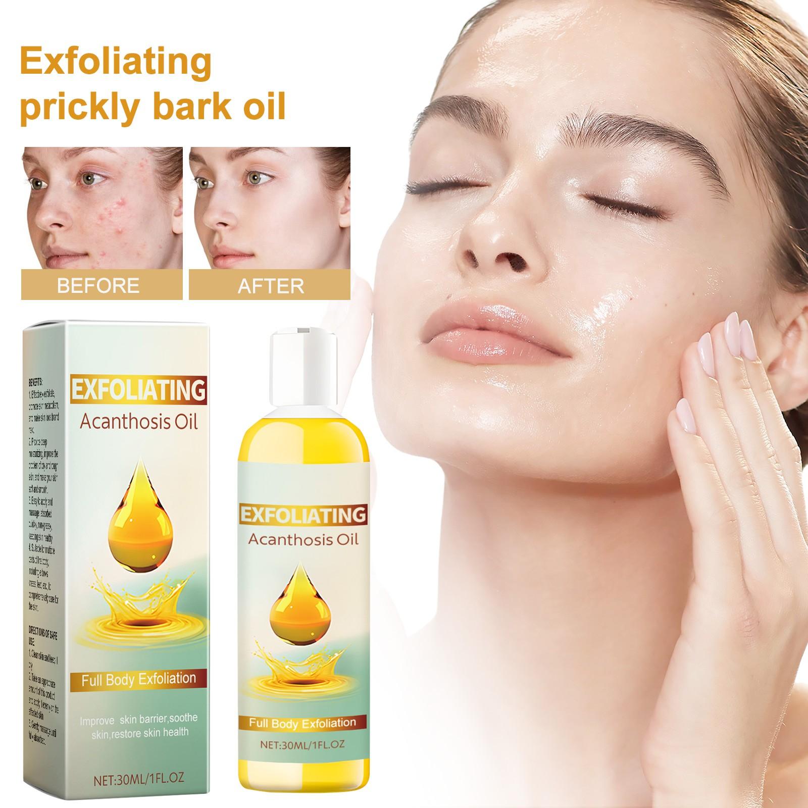 

Отшелушивающее средство для отшелушивания, масло для колючей кожи, масло-пилинг для ухода за всем телом, нежное отшелушивание, для поддержания гладкой и здоровой кожи, подходит, 30 мл