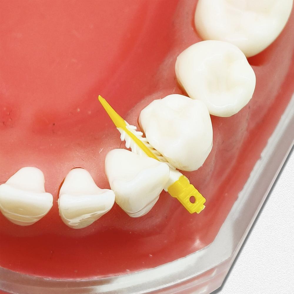 Coins composites dentaires, coins interdentaires adaptatifs, dentisterie, accessoires pour la thérapie de l'espacement des dents