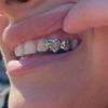 Hip-Hop Star Braces Hollow Smooth Electroplated Braces Gold Teeth Christmas Personalized Teeth Accessories