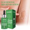 Ouhoe Scar Repair Serum For Smooth Skin Reduces Scars From Surgery And Pregnancy 30ml
