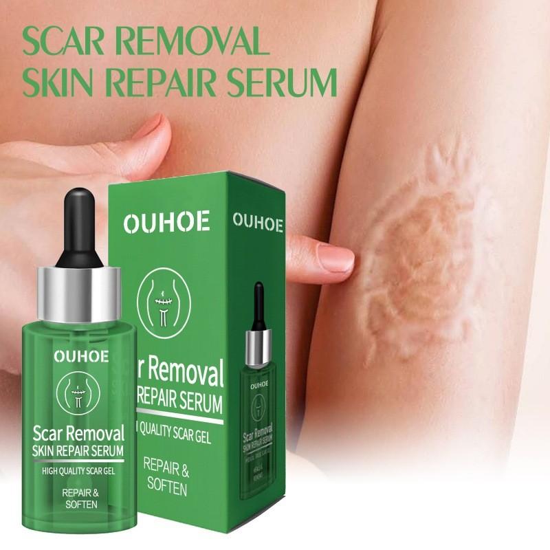 Ouhoe Scar Repair Serum For Smooth Skin Reduces Scars From Surgery And Pregnancy 30ml