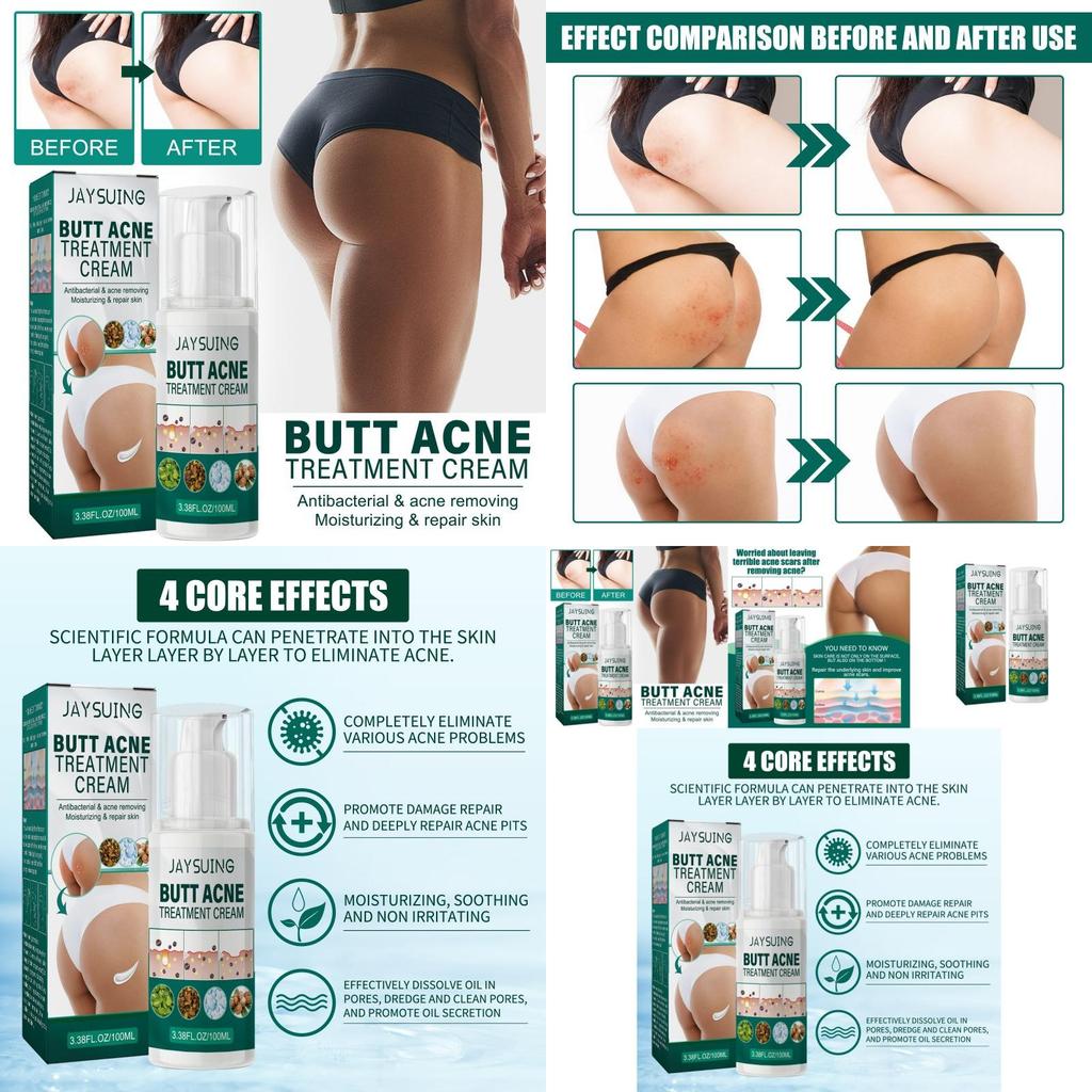 Jaysuing Butt Care Cream Nourishing Moisturizing Formula For Clear And Smooth Skin