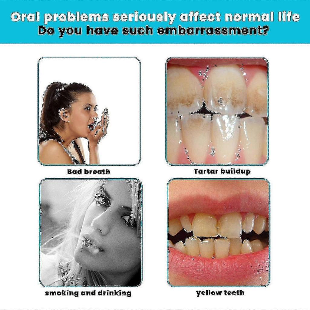 Ouhoe White Teeth Mousse Toothpaste Cleans Tartar, Fresh Breath, Anti-cavit |  |