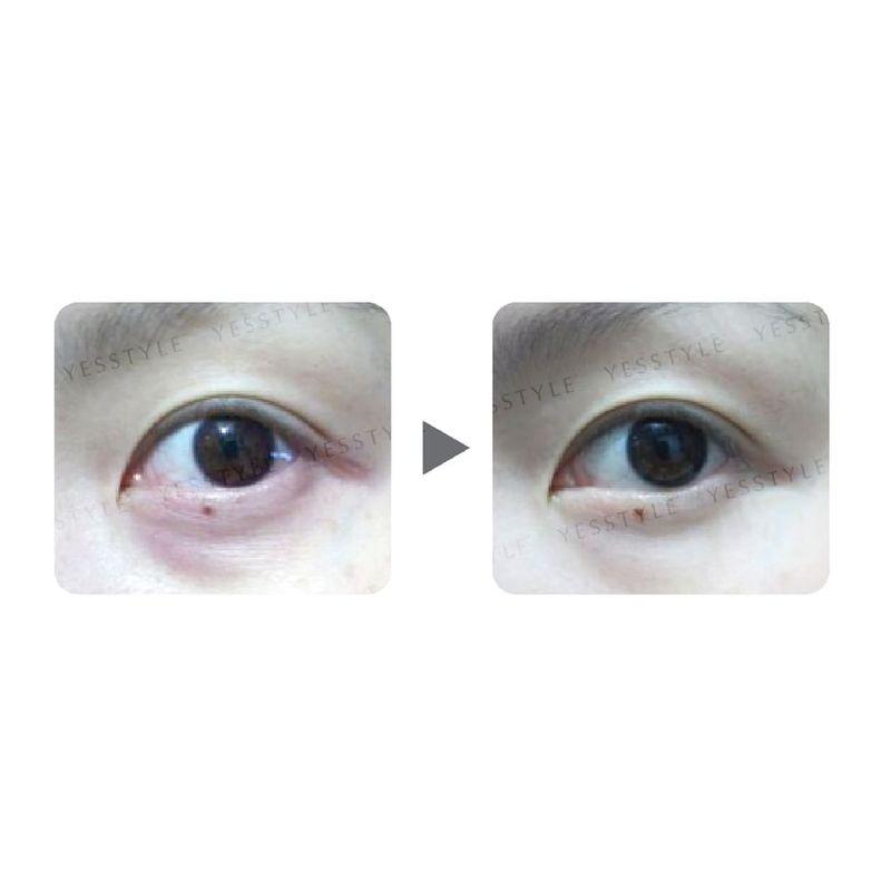 Zino - Dark Circle Removal Golden Eye Mask