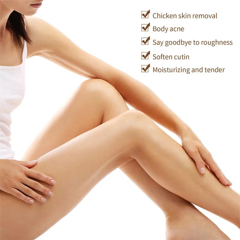 Body Whitening Cream Keratosis Pilaris Treatment Bumpy Rough Chicken Follicle Skin Repair Strawberry Legs Removal Dry Skin Care