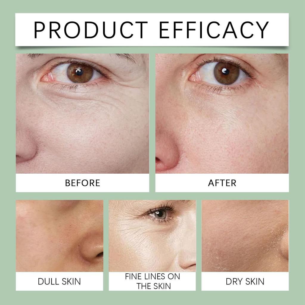 Talgfuktighetskrem, Talg Honning Fuktighetskrem, Fuktighetskrem, Hudforyngende Fuktighetskrem, Beroligende Mykgjører Sheasmør, Fri, 50g