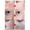 Skin Beauty Spot Removal Mask Brightening Skin Hydrating Moisturizing Mask Pore Shrinking Facial Treatment