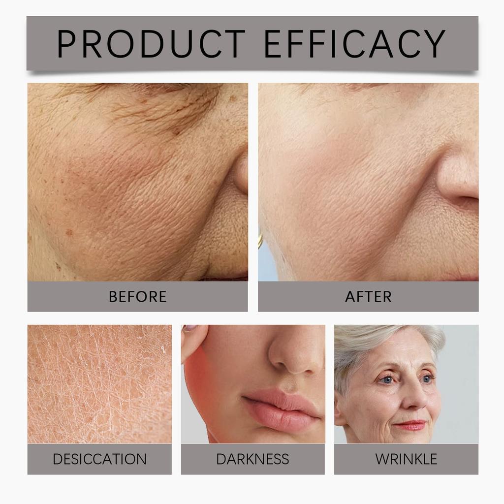 Wrinkle Cream, Even Out Skin Tone, Long-lasting Moisturizing And Rejuvenating Cream