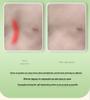 Korektor s přísavkou Pectus Excavatum pro prohlubeň hrudníku