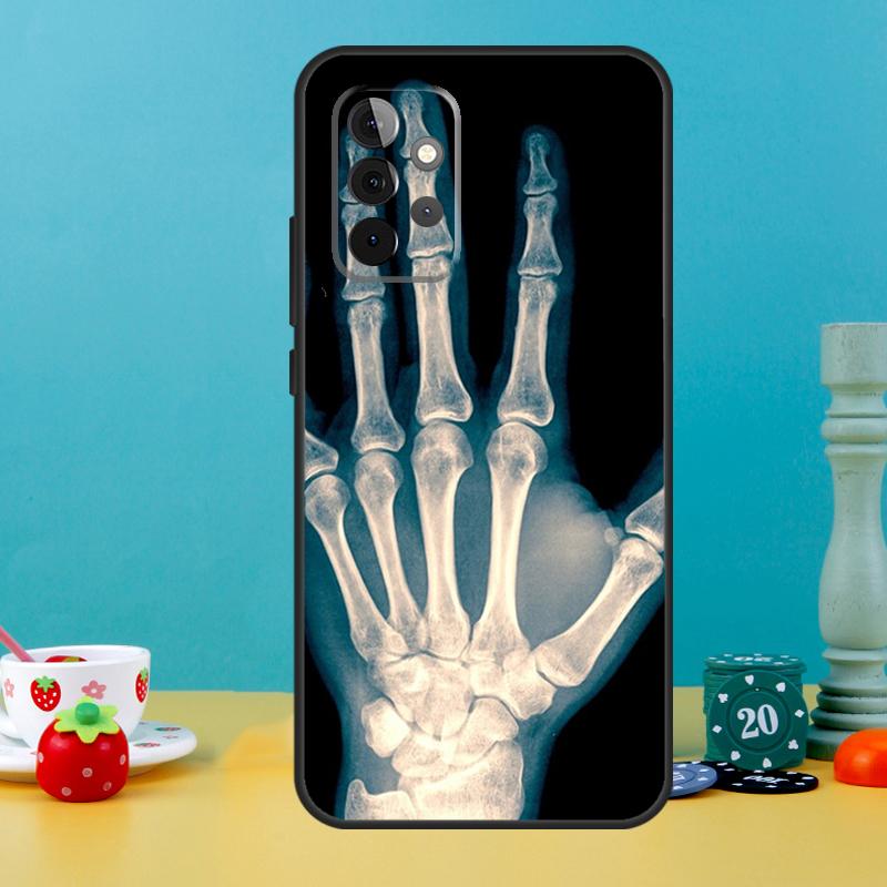 Skeleton Art Case For Samsung Galaxy A25 A54 A34 A14 A52 A32 A12 A13 A33 A53 A15 A16 A36 A56 A26 A05 A35 A55