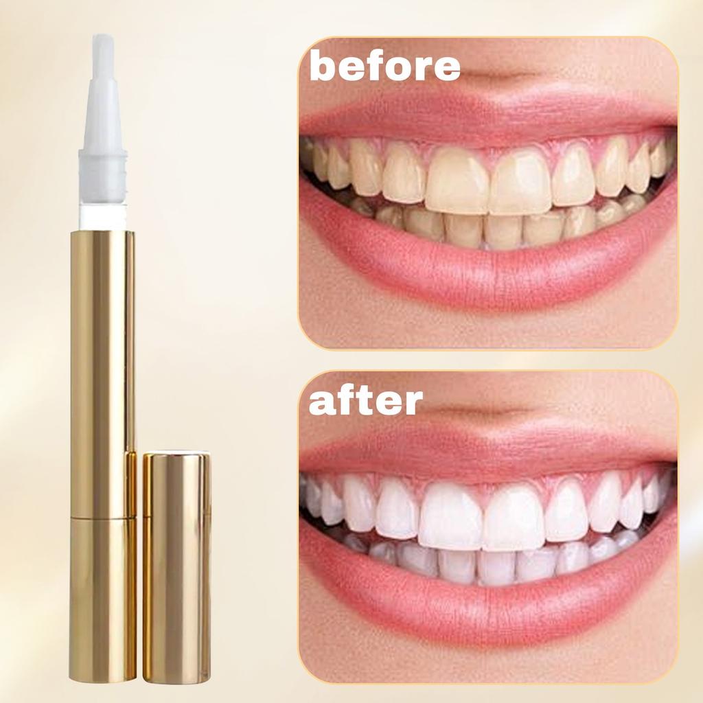 Der Zahnaufhellungsstift wird verwendet, um Verfärbungen zu entfernen, und kann ohne Empfindlichkeit für ein strahlenderes Lächeln verwendet werden. 4 ml