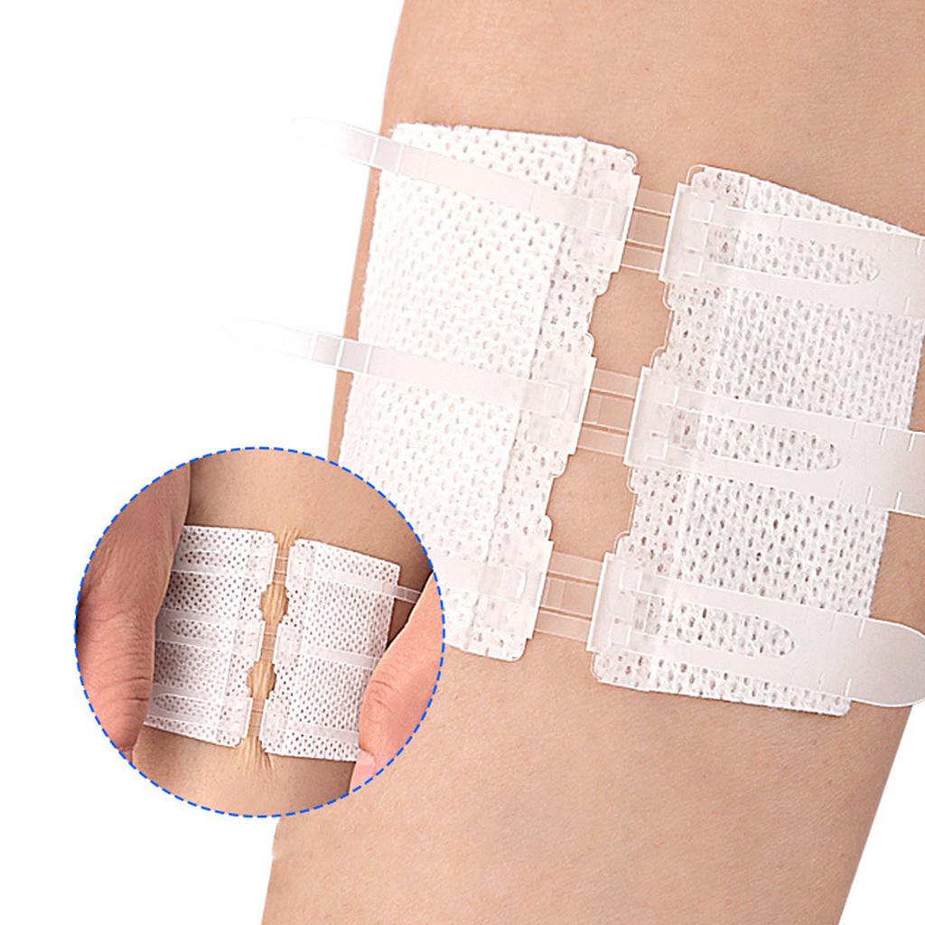 Emergency Wound Closure Strip Closure Device Laceration Repair Without Stitches Zip Stitch Sticker Adhesive Bandage