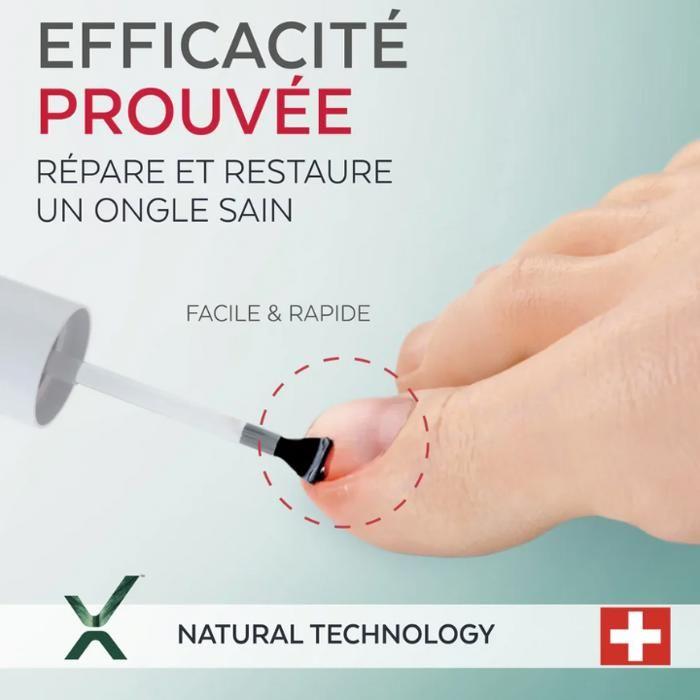 PODERM - Ingrown Toenails Serum - Relieves, Softens & Nourishes - 100% Natural Formula &; Vegan - Swiss Made - Flacon 8ml