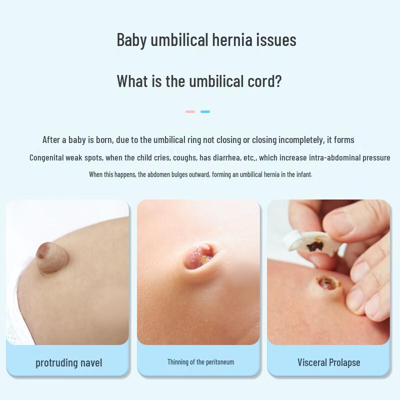 Mybaishi Baby Umbilical Hernia Patch