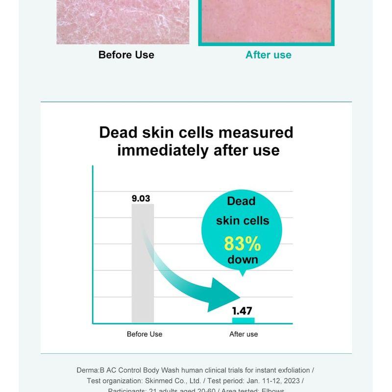 Derma: B - AC Control Body Wash