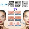 4 Piece Stainless Blackhead Remover Tool Set - Extractor Needle for Facial , Comedone Pusher, Home Kit