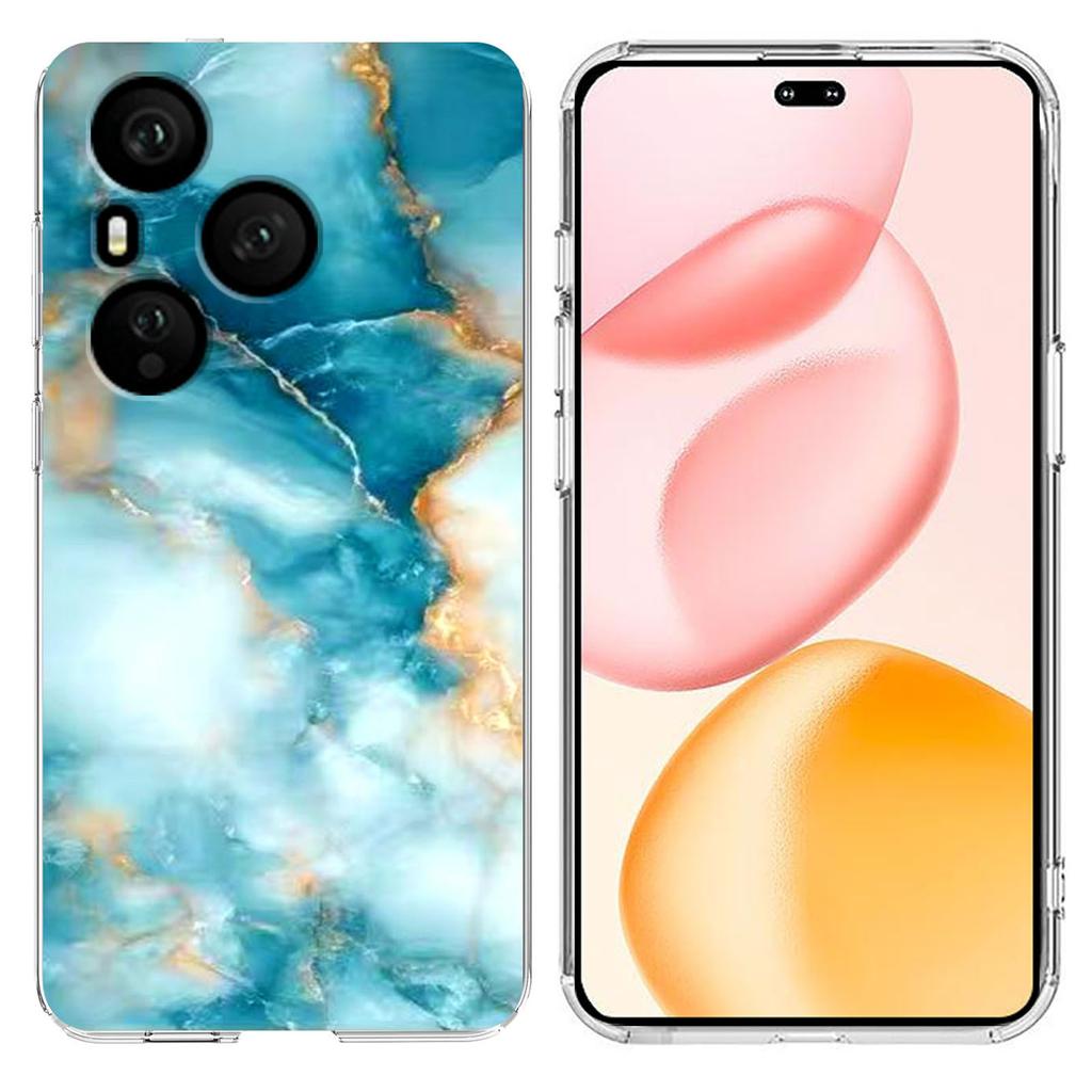 For Honor 400 Pro 5G (Global) Case Marble Pattern Printing Soft TPU Phone Cover