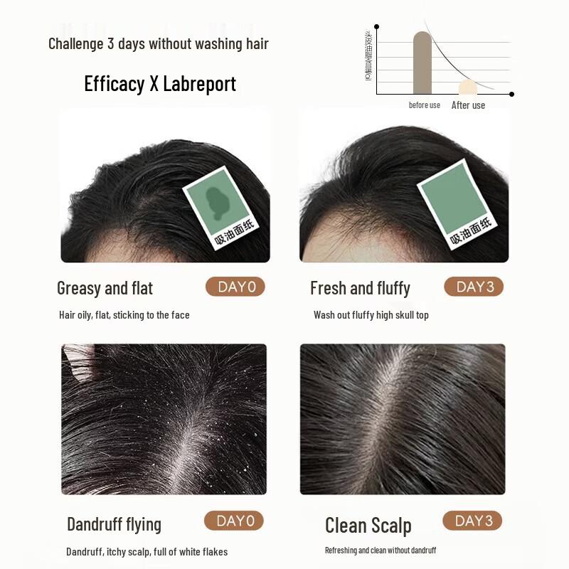 Baitie Balancing Anti-Dandruff Shampoo