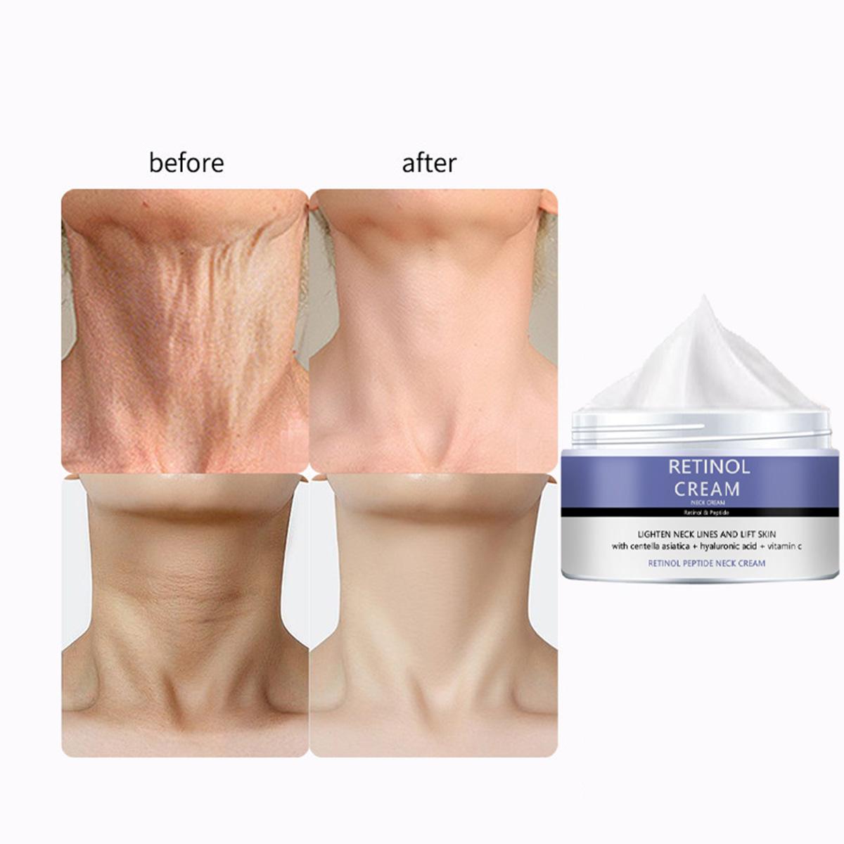 

Укрепляющий крем для шеи, нежный и не раздражающий, подтягивает кожу, разглаживает морщины, устраняет мелкие морщинки и улучшает цвет лица. 5g