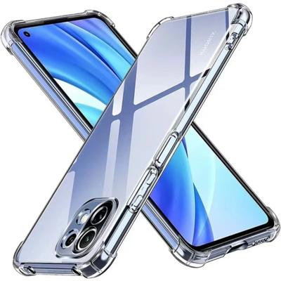 1.5MM Thick Air-Bag Clear Case for Xiaomi Mi 11 Lite 12S 12X 11T 12T 13 13T 14 Pro Mi11 Ultra Mi12 NE Mi13 Lite 5G Cover Fundas