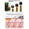 Ginger Hair Growth Products Fast Growing Hair Essential Oil Beauty Hair Care Prevent Hair Loss Oil  Treatment for Men Women