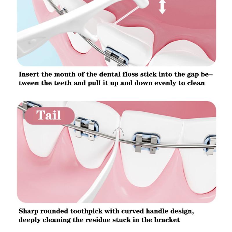 100Pcs/Pack Orthodontic Floss Bar Dental Bracket Steel Wire Slot Dental Floss For Orthodontic Teeth Orthodontic Floss Bar