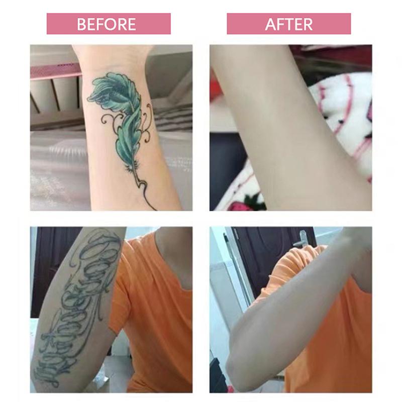 6Pc Waterproof Tattoo Flaw Conceal Tape Full Cover Concealer Sticker Body Arm