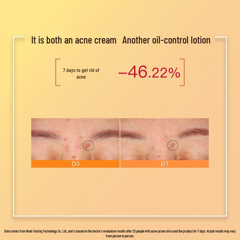 John Jeff 20% Azelainsäure Akne- & Ölkontrollcreme