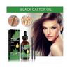 Ouhoe Castor Oil Hair Serum Improves Hairline, Strengthens Hair, Nourishes Hair Roots, Softens Hair And Prevents Hair Loss -jxlgv |  |